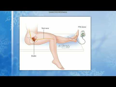 مثانے کا کنٹرول/حصہ-2/نیوروجینک مثانہ/تشخیص اور انتظام