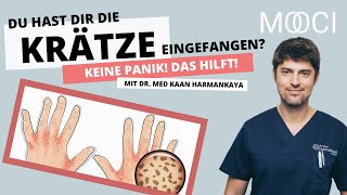 Krätze erkennen & behandeln! Das hilft gegen Milben!