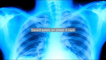 Deep learning model identifies patients with type 2 diabetes from X-rays