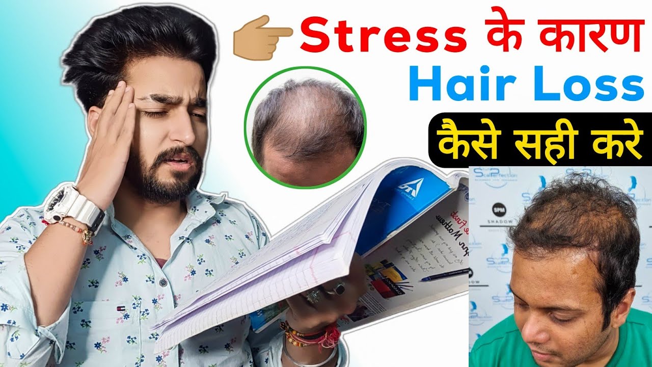 Stress Cause Hair Loss ? How to Stop Hair Loss YouTube