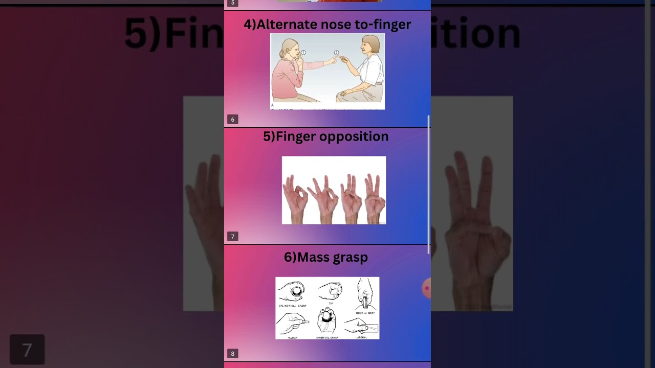 Coordination test for upper limb.Non Equilibrium test.#coordination #physiotherapy #physiotherapist