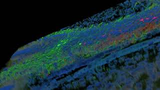 Supplementary Movie 6 Subiculum Rabies