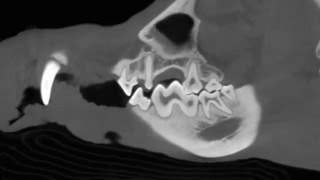 Dental Images Using Vimago - Dental Imaging Beyond Your Wildest Dreams...