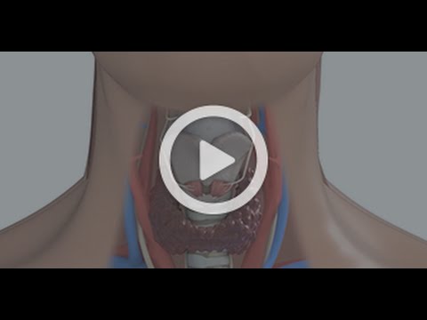 Video: Thyroid Tumor - Symptoms And Treatment