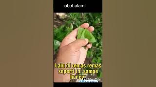 Obat Alami Sakit Gigi #resepdokter  #sakit #sakitgigi