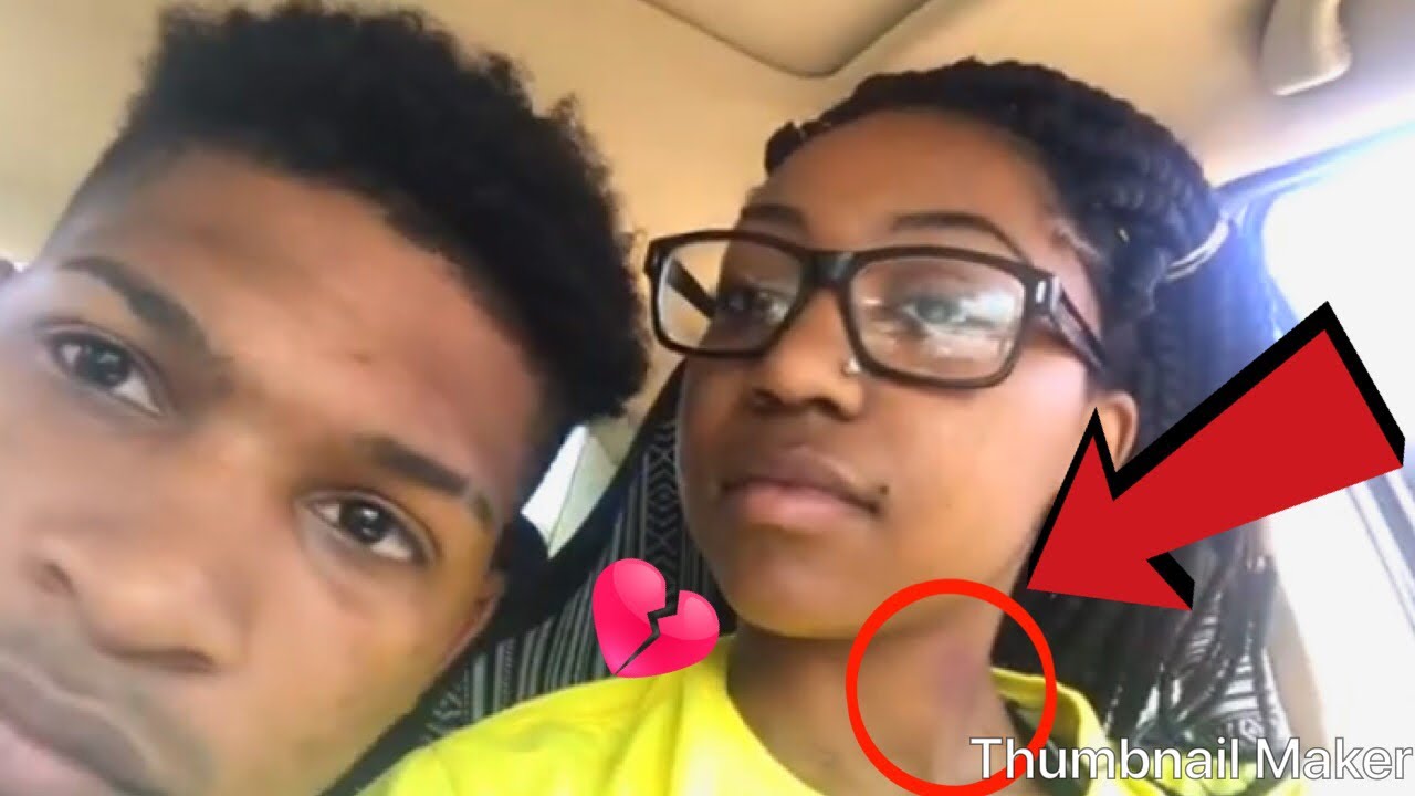 Hickey prank on boyfriend - YouTube