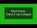 How to identify collapse on Chest X ray | Dr.Nikita