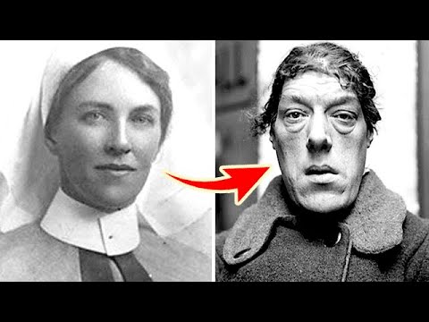 Из красавицы в чудовище. От историй этих женщин вы будете в шоке!