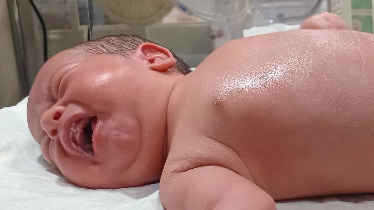Incubator Care with intensive Care In NICU #____ Premature Babies with Severe Hypothermia_ Subscribe
