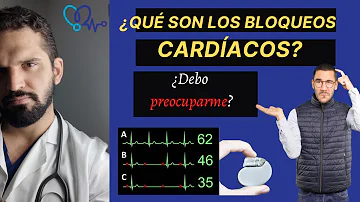 ¿Cuáles son los 3 tipos de bloqueos cardíacos?