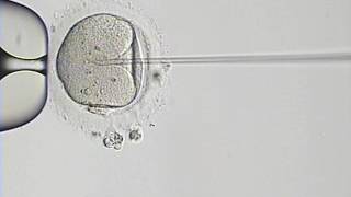 The process of ICSI as seen under the microscope