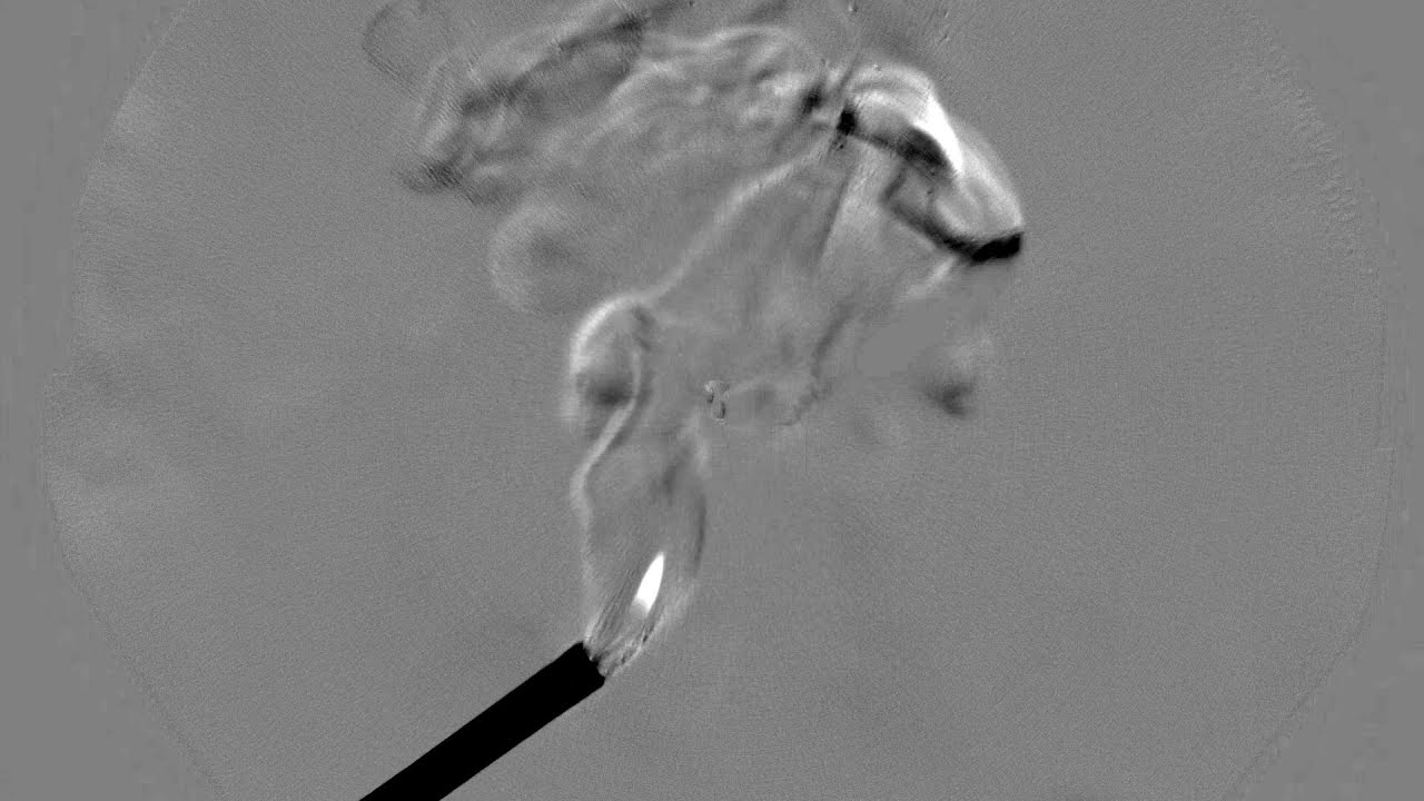 Fresnel Schlieren Optics: Seeing Heat on the Cheap