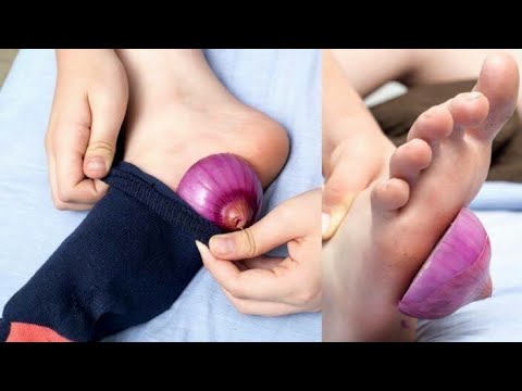 Jinsi Ya Kuondoa Sumu Kwa Njia Rahisi