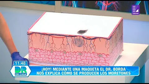 ¿Cuánto dura un puñetazo?