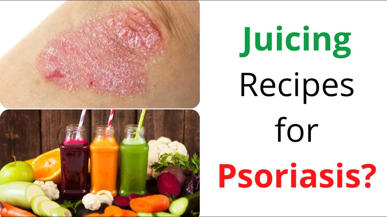 Juicing Recipes for Psoriasis YouTube