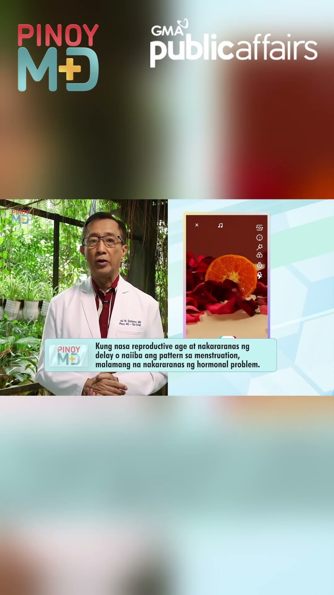 Delayed na regla kahit 'di buntis, ano ang sanhi? | Pinoy MD