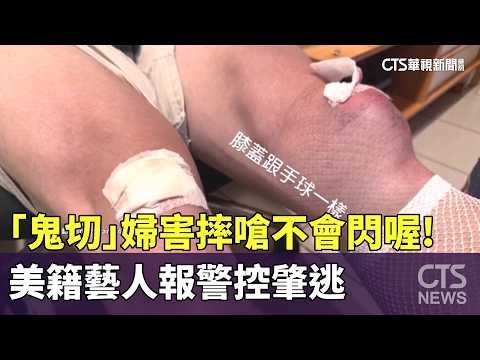 Cyclist "Swerves" and Causes Crash, Taunts Victim: "Learn to Dodge!" American Entertainer Files H...
