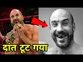 7 WWE रेसलर्स जिनके मैच के दौरान दांत टूट गए । 7 WWE Wrestlers Who Lost Teeth During Match!