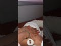 injection shorts #ytshorts #youtubevideo #injectionvlogs #injectionvideo #injection
