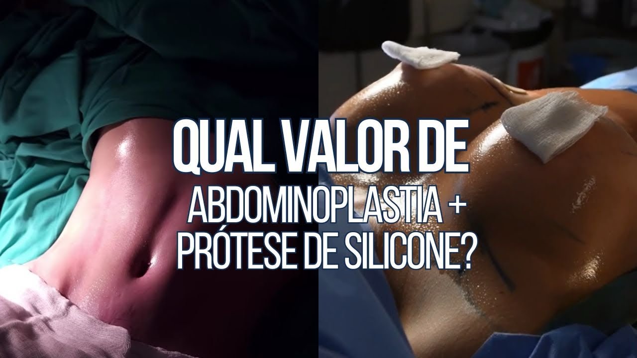 QUAL VALOR DE ABDOMINOPLASTIA COM PRÓTESE DE SILICONE? | CIRURGIA ...