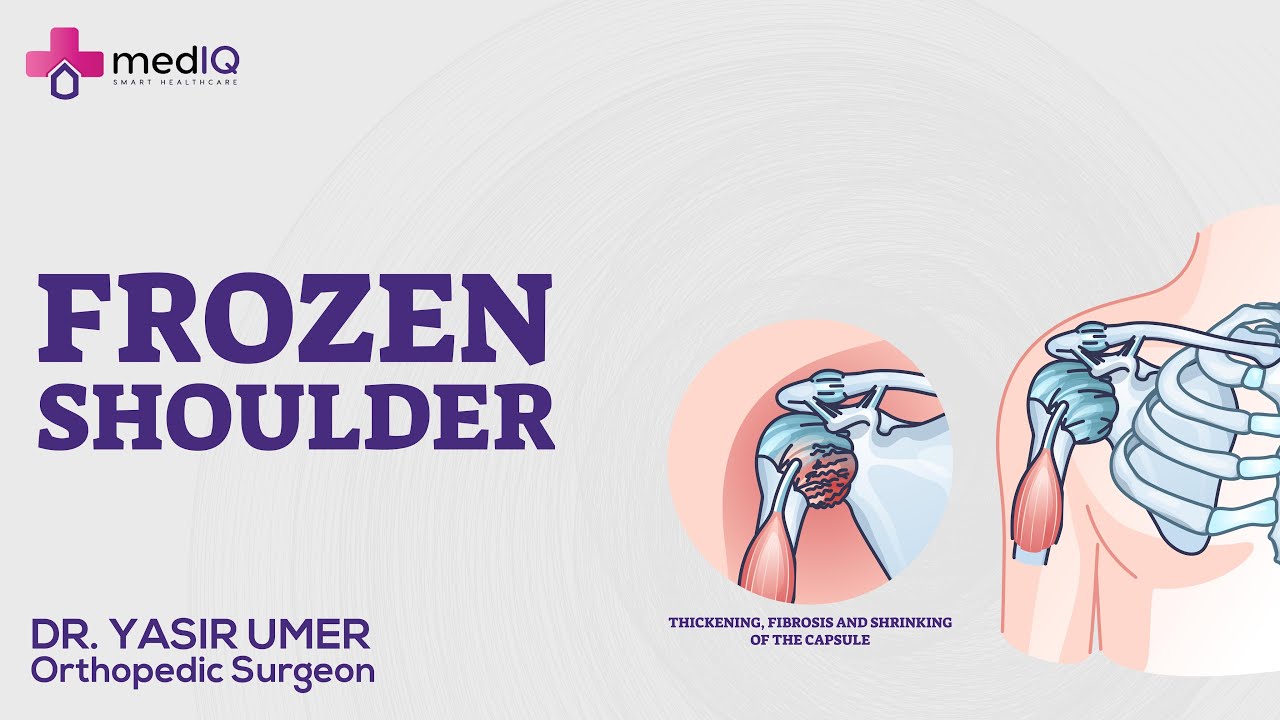 Mystery of Frozen Shoulder: Understanding the Three Phases and Treatment Methods