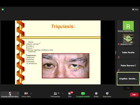 Diagnostico y Manejo Optométrico de Enfermedades del Segmento anterior (16/03/2020)