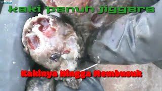 Sangat Mengerikan !! Kaki terkena Larva jigger sangat parah hingga terlihat seperti membusuk