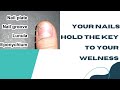 How the White Half-Moons on your Nails Reflect Your Wellbeing.