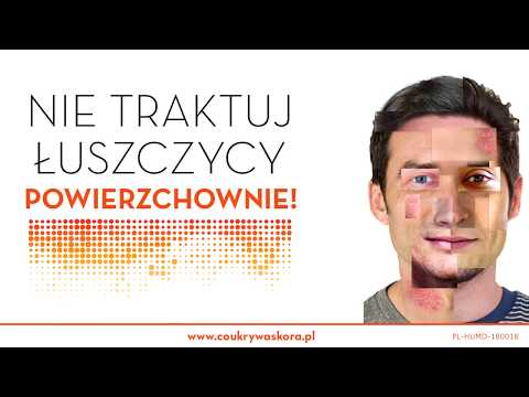 Wideo: Leczenie Systemowe łuszczycy: 8 Pytań Do Lekarza