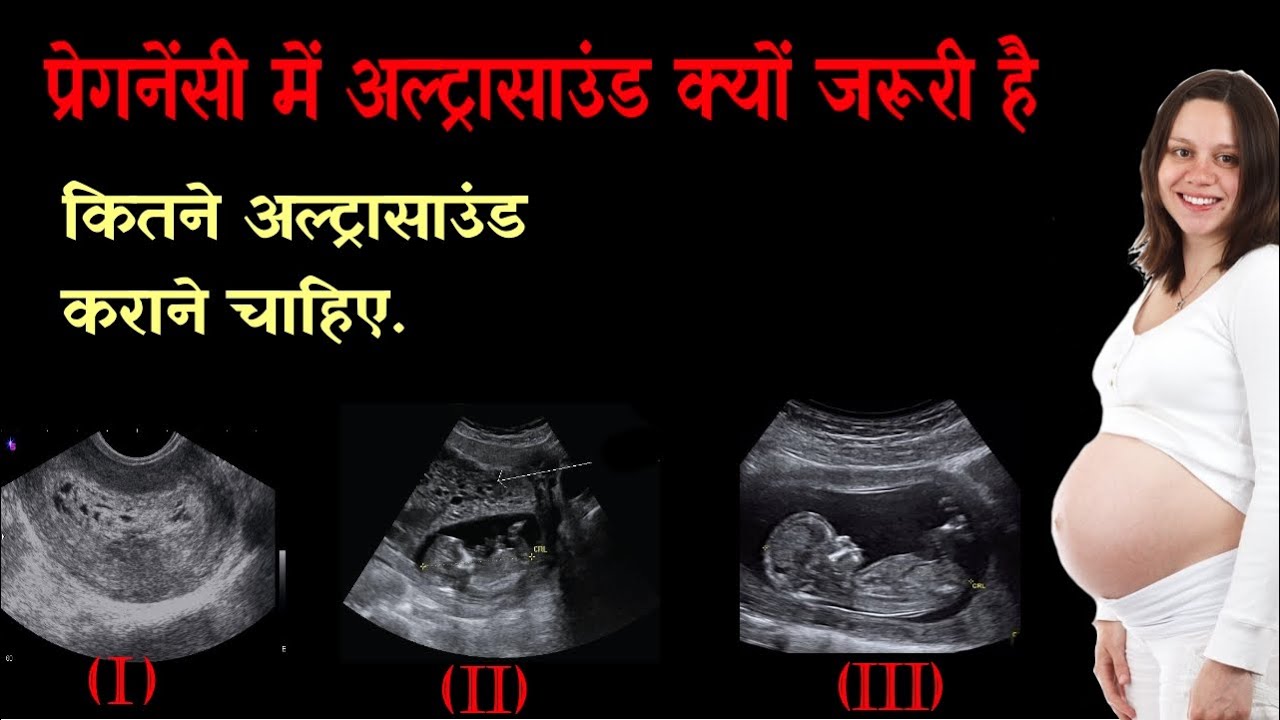 Pregnancy me ultrasound kab karna chahiye Baby ultrasound in