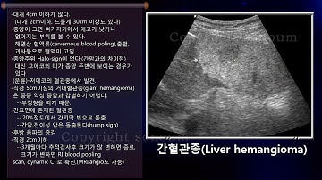 [소노엠 메디컬 아카데미]  간혈관종 초음파 image Finding