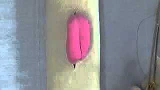Cushing and connell suture pattern