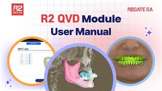 R2GateSA Tutorial Series | QVD module & Digital Full-Mouth Workflow