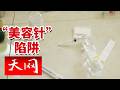 《天网》瘦脸针变 “烂脸针”！医美机构反常推诿 假肉毒素黑产源头究竟在哪？20260618