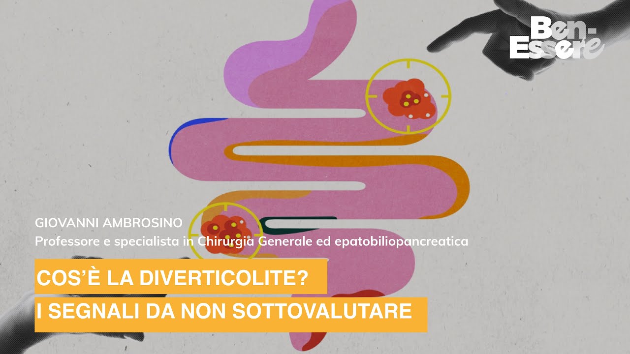 COS’È LA DIVERTICOLITE? I SEGNALI DA NON SOTTOVALUTARE - YouTube