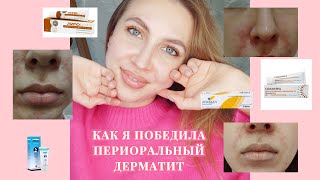 ПЕРИОРАЛЬНЫЙ ДЕРМАТИТ| ЛЕЧЕНИЕ, КОТОРОЕ ПОМОГЛО