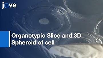 Organotypic Brain Slice and 3D Spheroid of Cancer Cells | Protocol Preview