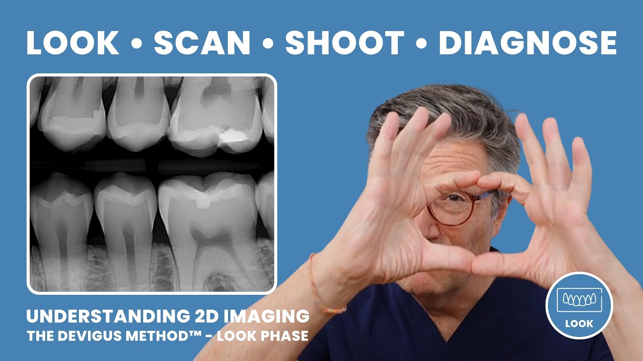 5 Things You're Doing WRONG with 2D Dental Radiographs