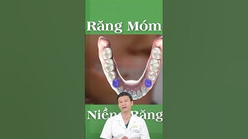 NIỀNG RĂNG MÓM | Bác Sĩ Yên