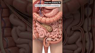 US Illustration Of Stuck Constipation Moving Gut Health Body Arts ...