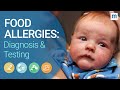 How Food Allergies Are Tested