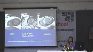 MRI School : Lecture 19 Advanced Cardiac Applications