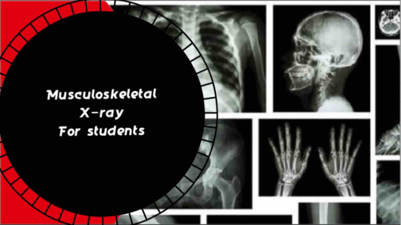 musculoskeletal x rays YouTube