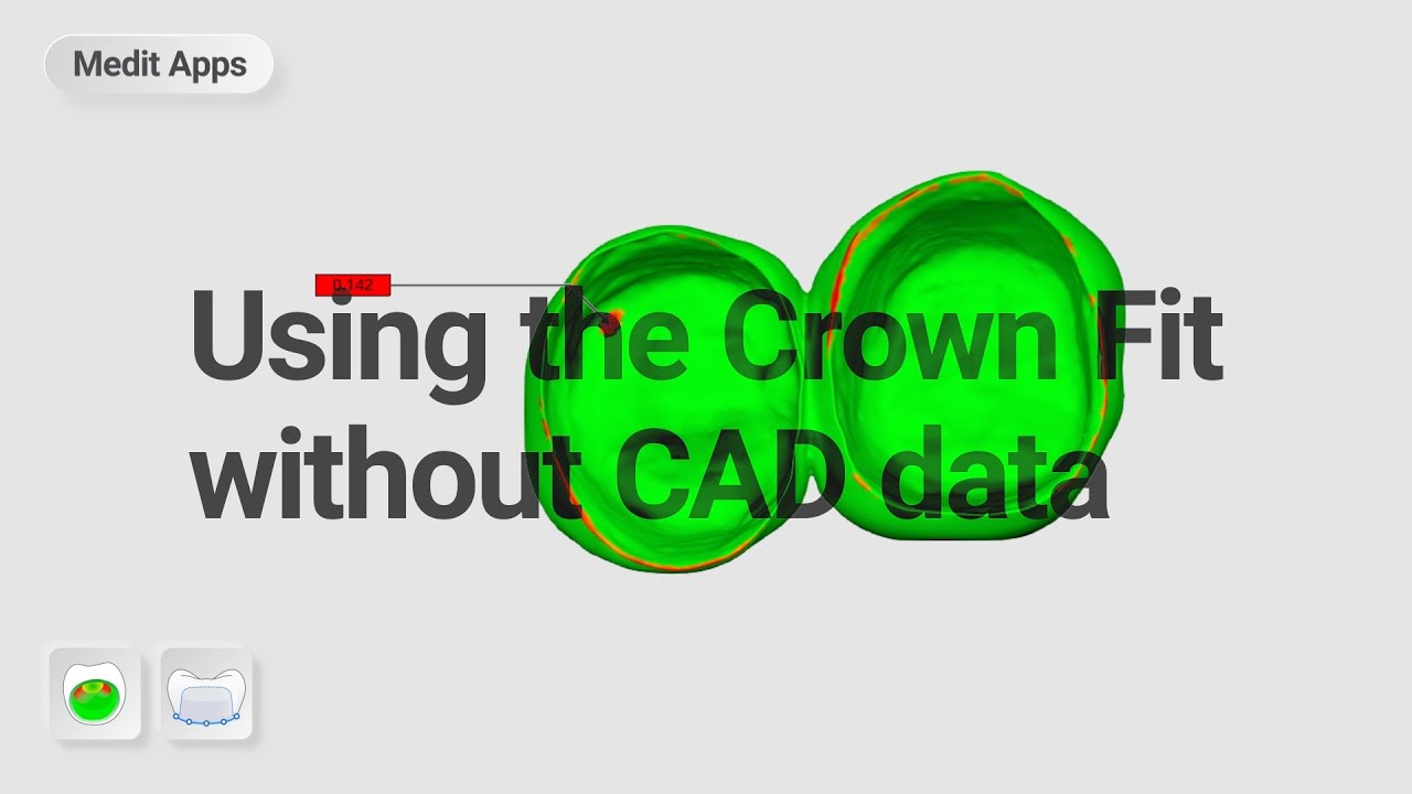 Using the 'Crown Fit' without CAD data YouTube
