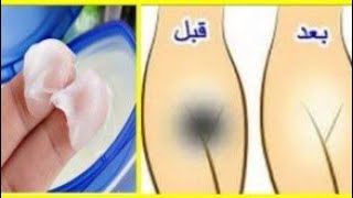 تفتيح المناطق الحساسه في أقل من ١٠ ايام