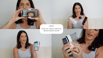 Bitesoft Co | Dental Monitoring Scans