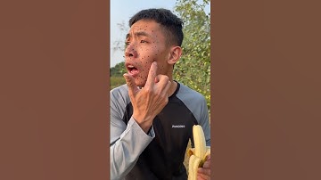 How I Treated My Acne in the Forest Using Onl# shorts 😆🌻🦚🍌🍓#218