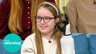 Meet The Children With Life-Changing Bionic Arms | This Morning