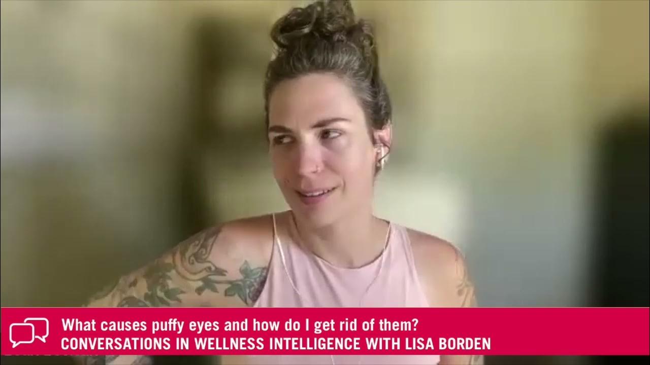 what-causes-puffy-eyes-and-how-do-i-get-rid-of-them-youtube