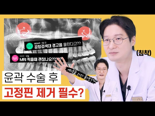 [안면윤곽 고정핀] 윤곽 수술 후 고정핀! 금속 감지기에 걸리는거 아니야?!😨꼭 제거해야 할까요??